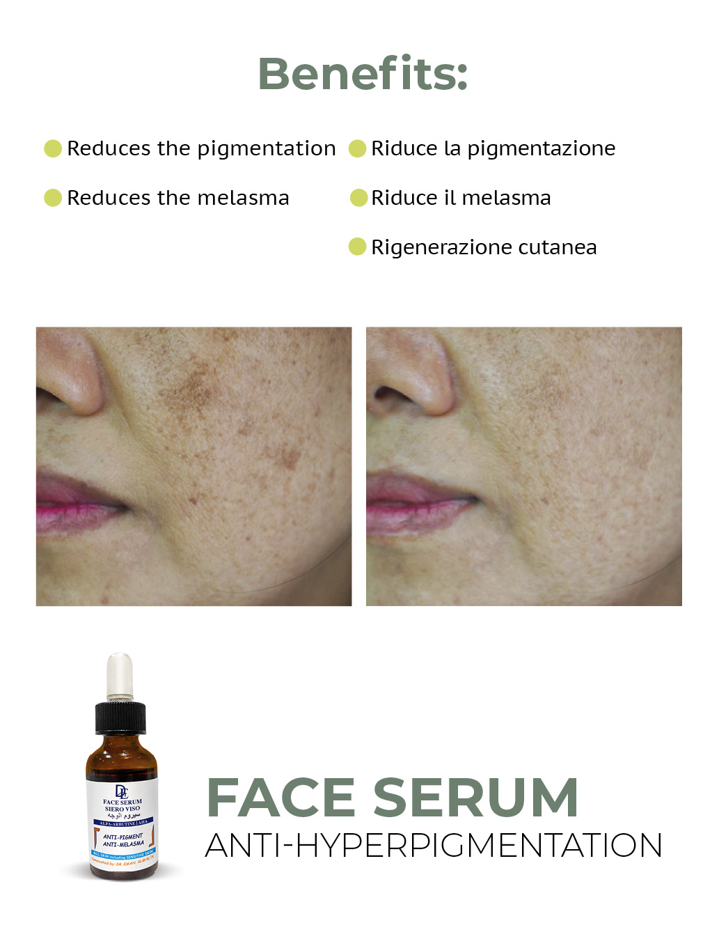 Face & neck serum " Anti-Pigments, Anti-marks" سيروم الوجه ضد الكلف والتصيغات العميقة - Image 3