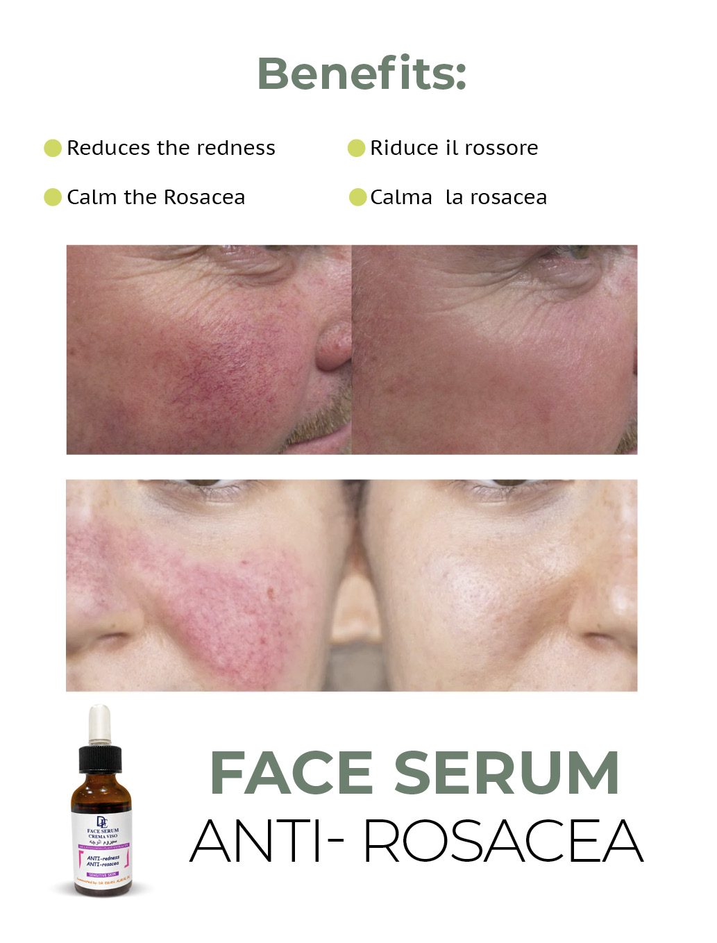 face serum "anti-redness, Anti-irritation" سيروم الوجه ضد الحمرة والوردية - Image 3